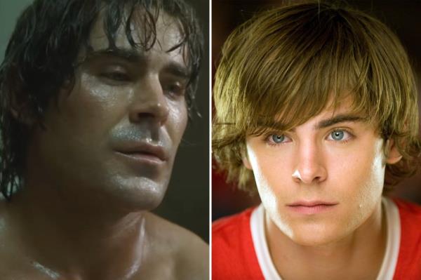 zac efron face, zac efron plastic surgery