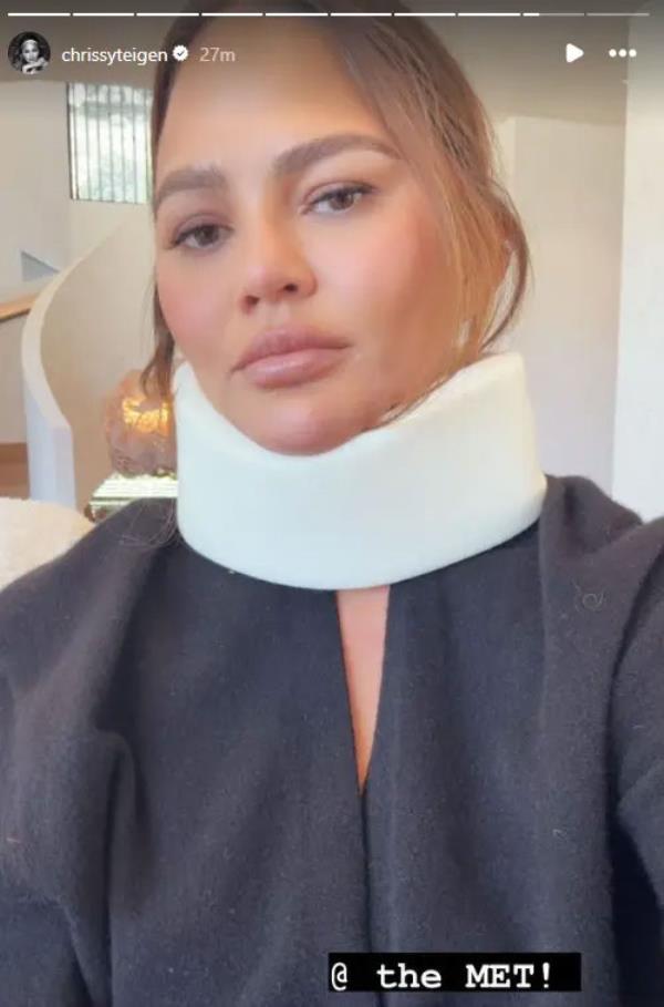 Chrissy Teigen sported a neck brace hours before the 2024 Met Gala kicked off.